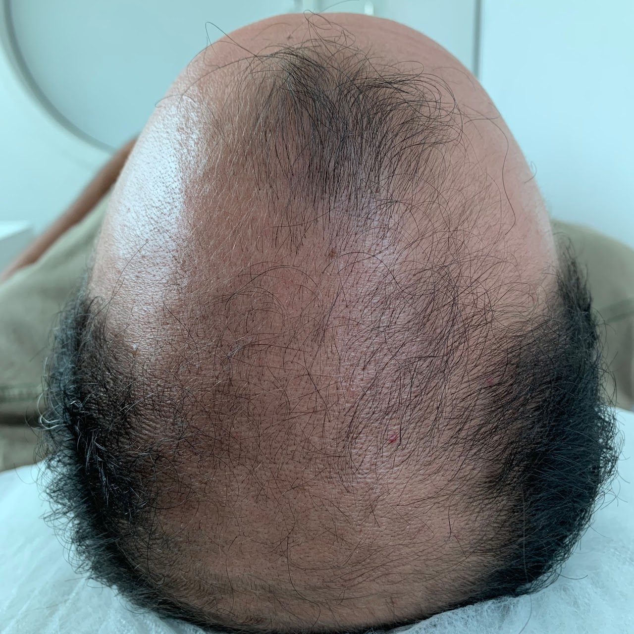 Estímulo ao crescimento